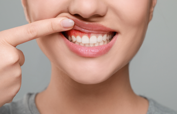 Person exposing their upper gums with a finger, showing redness and inflammation.